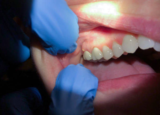 Best Emergency Dental Surgery in Merchantville, NJ